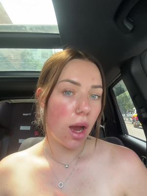 ITSSSSS TIMEEEEE @THE INJECTABLES QUEEN 