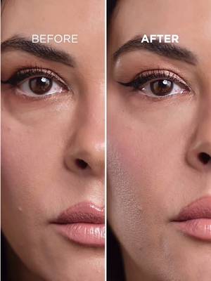 Instantly tighten, firm and smooth under-eye bags for up to 8 hours with Eye Bag Instant Eraser. 