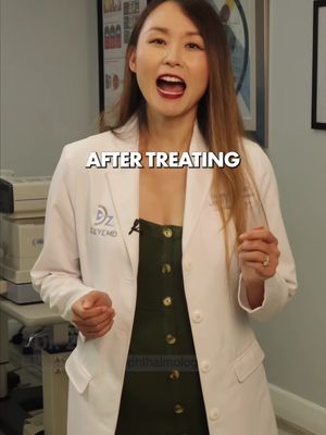 You don't just "Have to live with" floaters! 🙅‍♀️  After years of treatment, I disagree with doctors who say otherwise. Modern options like laser vitriolysis can safely break down floaters for some patients, and pupil-dilating drops can reduce their visibility. If floaters are disrupting your reading or driving, track when they happen and see a specialist. #EyeFloaters #Floaters #VisionTreatment #Vitriolysis #Ophthalmology #EyeHealth