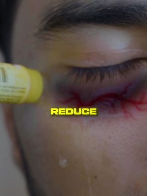 If your eye look tired try this hack 