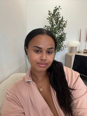 In the first clip I was wearing concealer on my face woopsies, last clip I had a bit of under eye concealer  on (I did purge abit on day 2/3 & peel) but do you notice a difference? #microneedling #beforeandafter #fyp #skincare 
