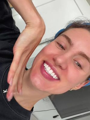 I do not funk around when it comes to my smile. People will see you coming from a mile away 🦷 😀  Link: https://liketk.it/5R0hn #whitening #teethwhitening #whiteteeth #fyp #viral 