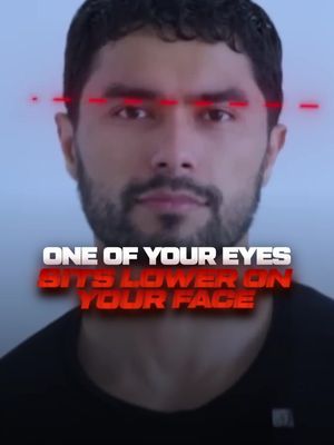 If your face or eyes look asymetrical. Try this at home stretch 