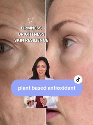 the science behind chebula in skincare for my girlies who love plant-based skincare. the @True Botanicals chebula active serum definitely surprised me. leave any questions below 💗 #truebotanicalspartner #dermatologist #naturalskincare #plantbased
