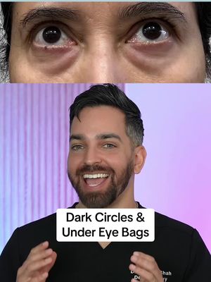 Dark circles and under eye bags, we finally have a REMEDY @Remedy Science 