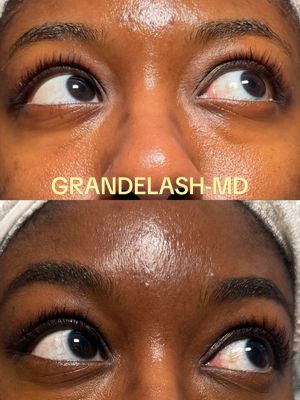 The lashes are FLOURISHING ✨ #AD  For the past several weeks, I have not been playing about my lash routine which is @Grande Cosmetics GrandeLash-MD once a day.    As a girl who doesn’t do false lashes or lash extensions, I need my natural lashes to show up and show out!! Using this serum has been helping my real lashes stay on point. 😍 #grandepartner @sephora #sephorasquad 