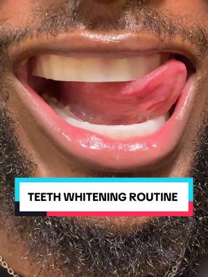 1. Retainers - @ClearRetain  2. Dental pod, retainer case - @Zima Dental  3. Oil pulling- @GuruNanda LLC  4. Whitening Toothpaste - @Euthymol US @Euthymol UK  5. Floss, Electric toothbrush - @Oral-B Brasil  6. Tongue scraper, mechanical toothbrush - @Amazon   7. Whitening strips - @Opalescence  8. LED teeth whitening - @Moon Oral Beauty  9. Mint - @ALTOIDS 