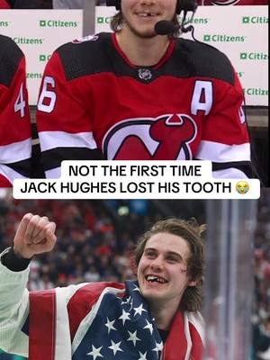 No jib has never been a problem for Jack Hughes 😏🦷🥇 #teamusa #olympics #hockey #jackhughes #nhlontnt 