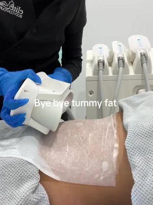 👀 Looking for a non-surgical way to sculpt your shape!? Our Fat Freezing Treatment eliminates stubborn areas with zero downtime! Backed by science, real visible results. #cryo #coolsculpting #fyp #australia 