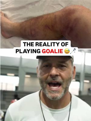 “Why would you EVER want to play goalie?” 😂🧱 Teams average over 45 shots EACH at the Championship Series. 😳 Friendly reminder from @bphipper30’s leg— Goalies are a different BREED. 