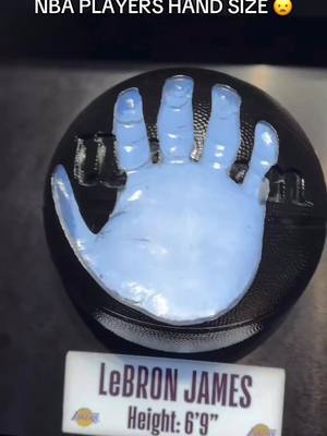 Kawhi Leonard’s hand 😦 (🎥:Kya0ki/ig) #NBA 