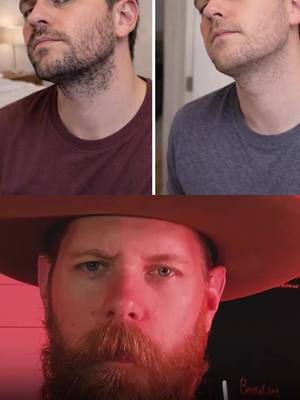 Patchy or Thin Beard? Two Different Problems. Two Different Solutions. | Beard Insecurity (1/5)