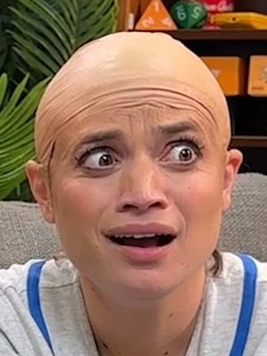 Who is serving baldness the best? 🧑‍🦲