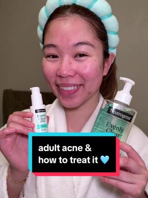 #ad the way this line treats acne and post-acne marks at the same time 😍 #EvenlyClear #TargetPartner #Target @Neutrogena @target @LTK #liketkit https://www.shopltk.com/explore/@dewylouie 