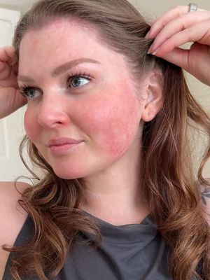 Over the last 4 weeks I've been testing YTTP's New 15% Vitamin C Bright Cell Serum with N.A.D + Complex & am so happy with the improvement I've seen. Prior to this serum I was really struggling to successfully fade my post blemish dark sports. I'm also super excited to have found a Vitamin C serum that works for my sensitive skin🙌🏻 @Youth To The People available at @sephoracanada #YTTP_Partner #vitaminc #skincare