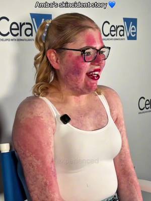 episode three of skincident confessionals with @Amba Smith ✨ a fan of our intensive moisturising lotion since 2019 to help with the dryness from her birthmark 💙 #cerave #skincident 