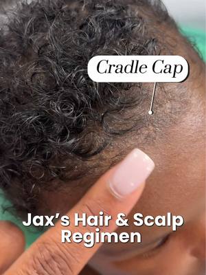 How we got rid of Jax’s cradle cap! The easiest and simplest hair regimen that works like a charm! @Dr. Eddie @Baby Dove @freeyourcurlsofficial #postpartummom #cradlecap #babyhair #babyhack #sahmroutine #newbornsoftiktok #newbornbabies #momtipsandtricks #newbornmom 