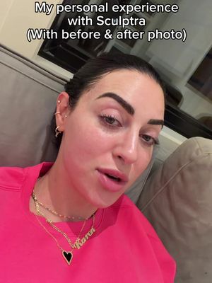 Hoping this helps someone looking for someone’s personal experience  . #skinhealth 