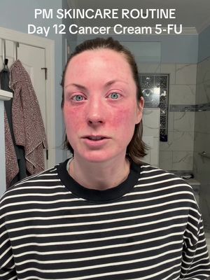 Day 12/14 PM Skincare routine and prep before my 5-FU (fluorouracil) cancer cream treatment. This is a topical chemotherapy!  #skincancer #fluorouracil #basalcellcarcinoma  