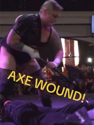 #mickieknuckles gives @Angel Metro a gnarly AXE WOUND! 🪓☠️🩸 Yeeouch!  #combatzonewrestling #wrestlingtok #deathmatch #angelmetro 