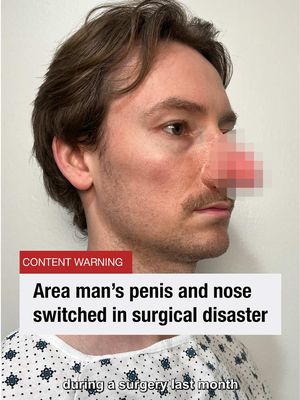 True story btw 😢 #news #scary #surgery #doctorsoftiktok #foryou @therealdell @Kevin Sanji @kelseyjunejensen @fogie 