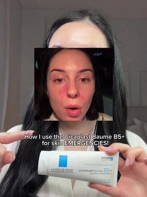 My Skin Emergency 🚨 Must Have In My Skincare Drawer is The @larocheposay Cicaplast Baume B5+ Due To It’s Multi-Functional Use! Ad 💧#LaRochePosay #Cicaplast #AD #Skincare