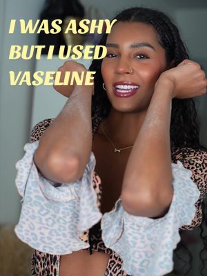 Moisture is key, that’s why I chose Vaseline. Anybody else try it yet? 👀 @Vaseline 
