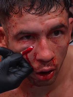 That cut on Axel Sola is no joke 😳 #UFC #mma #axelsola