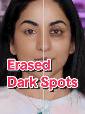 This covers all your hyperpigmentation, dark circles and spots, and gives you the most natural look. Deets: MILANI | Conceal + Perfect Longwear Concealer ESSENCE | Correct & Conceal Under Eye Brightening Concealer ONE/SIZE BY PATRICK STARRR | Ultimate Blurring Setting Powder @ONE SIZE BEAUTY @essence.cosmetics @Milani Cosmetics #makeup #makeuptutorial #concealer #everydaymakeup #darkcircles 