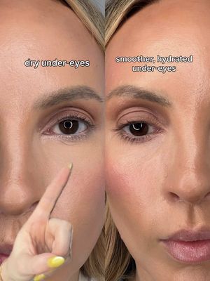 I was super insecure with the skin around my under eyes. They were just always dry and tired looking and I felt like I tried 8 million different eye creams with no luck until...this @Parívie one🤌🏻 It's packed with peptides and really good hydrators, so it actually helps smooth everything out and keep that area from looking crepey. Thank you Paris!!😄 #parivie #pariviebeauty #eyecreams 