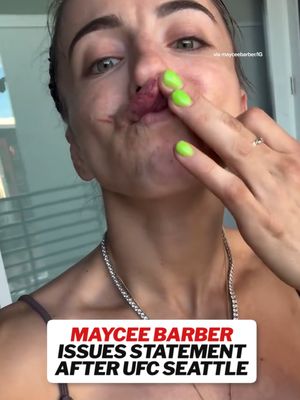 Heal up, Maycee 🙏 (via mayceebarber/IG) #UFC #MayceeBarber