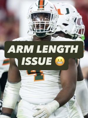 “Every D-Line coach I’ve talked to, they believe it’s a problem” Gerald thinks Rueben Bain’s arm length could hurt his draft stock 😬 #nfl #miami #nfldraft