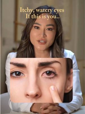 Did you know annoying irritated eyes can actually be because of nasal inflammation? 👀 Lucky you, Flonase works upstream to calm that source. 💯 Some people feel relief the same day, but daily use will keep those eyes open all season!😎