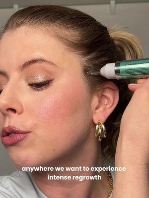 PSA: It is possible to treat hair loss at home!!  #AD I love how K Beauty always brings us science-backed protocols at affordable prices. This @VT Cosmetics US Reedle Shot Ampoule and Hair Brush Serum are on sale only here on TikTok shop, so stock up while you can!! #vtcosmeticspartner #ReedleShot #VTcosmetics #VThairgrowthshot 