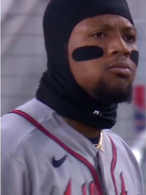 Ronald Acuña Jr. left the game after being hit by a pitch for the second time, then in the bottom of the inning Bryce Elder plunked CJ Abrams