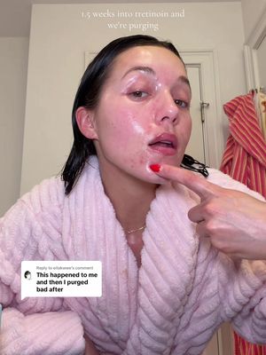 Replying to @eitakwwe will keep you guys posted❤️‍🩹 #acne #skincareroutine #tretinoin #acnejourney #azelaicacid 