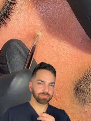 Ouch @Basem khaled    متخصص بشره 