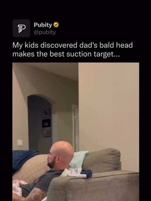 👨‍🦲 Suction cups work because of atmospheric pressure, which is roughly 14.7 pounds per square inch at sea level. A smooth, slightly damp surface like a bald scalp creates just enough of an airtight seal for a child’s cheap toy to cling impressively hard, which is exactly why kids everywhere seem to discover this at the same age. It turns out balding might be nature’s way of preparing fathers for their children’s first physics experiment. #Pubity #RoadTo19M   (@_nikki_1010 via Collab)