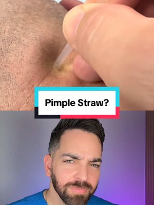 Replying to @Tim  wtf is a pimple straw? This was clean 
