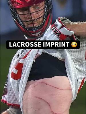 Jack Rowlett was a trooper for this 😳 What a flashback