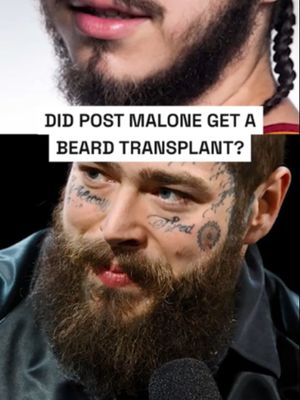 Post Malone Beard Breakdown