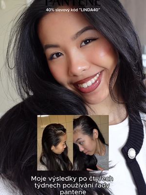 Placená spolupráce s Pantene Moje výsledky po pár týdnech používání… 🤍 Upřímně jsem nečekala, že péče o pokožku hlavy může udělat takový rozdíl. Začala jsem používat řadu Pantene Grow Abundant a zaměřila se víc právě na scalp care – a postupně jsem začala vnímat změnu. Moje vlasy působí silnější, zdravější a celkově mám pocit, že jich při mytí a česání vypadává méně ✨ Řada obsahuje antioxidanty, niacinamid a Pantene Pro-V komplex, které pomáhají zlepšit stav pokožky hlavy a tím snížit vypadávání vlasů. Najdete na @Notino CZ/SK se slevovým kódem: LINDA40 Video od @Abbey Yung  #Pantene #PanteneHair #GrowAbundant #protiVypadavaniVlasu