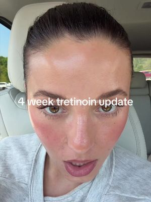 4 week tretinoin .025% update!! #tretinoin #tretinoinjourney #acnejourney #acneskincare #glassskin 