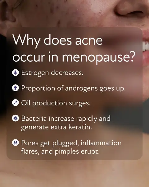 Menopausal acne can feel frustrating, but with the right approach, it's treatable. If gentle skincare, proper hydration, and targeted treatments aren’t giving you results, it may be time to address the root cause from within. Hormonal changes often play a key role, and options like #hormonereplacementtherapy can help support clearer, healthier skin. Want to learn how to improve your skin during menopause? Comment “journal.” #hrtmenopause #menopauseskin #menopauseacne #agingacne  