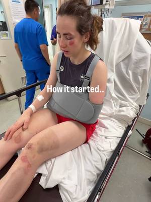 almost three months ago since breaking my collarbone #cycling #fixedgear #athlete #injuryrecovery 