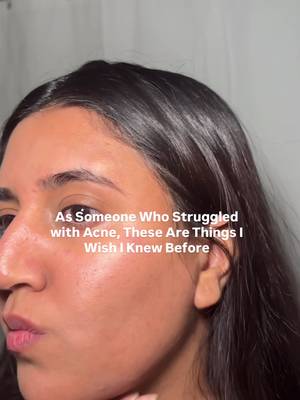 If you are struggling with acne read this 👇 Things I wish I knew before struggling with acne for years 🥲 • not all acne is actually acne• sometimes it’s fungal acne, and treating it like regular acne can make it worse• oil cleansers were triggering my skin more than helping it• switching to fungal acne-safe products made a bigger difference than buying more skincare• keeping my routine simple helped my skin heal faster• you don’t need a 10 step routine• washing with just water in the morning actually helped calm my skin• over-exfoliating damaged my skin barrier and caused more breakouts• less products = less irritation sometimes I genuinely wish I learned this sooner because my skin improved so much faster once I simplified everything 🤍 #acne #fungalacne #skincare