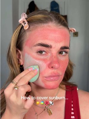 How to cover sunburn ☀️ ib @kayla ryan @M·A·C Cosmetics green colour corrector @Makeup Revolution colour corrector @MaybellineUK foundation, concealer @essence cosmetics cream bronzer @e.l.f. Cosmetics UK blush @Huda Beauty powder @rimmellondon lipgloss #makeuptrends #sunburn #sunburnmakeup #makeuphacks 