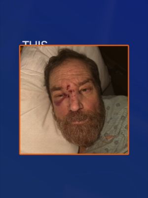 An assault inside a memory care facility raises serious questions about safety, supervision, and accountability. When vulnerable residents are injured in places meant to protect them, families are often left searching for answers about what happened and whether it could have been prevented. Investigations into facility responsibility often focus on staffing, supervision, and response protocols. #NursingHomeNeglect #MemoryCare #PersonalInjury #ElderAbuse #TexasLaw