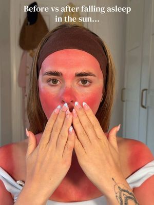 Who wants to see me cover this?… #makeuptrends #sunburn #sunburnmakeup #satire #ragebaiter 