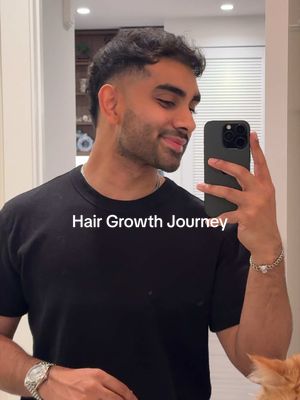 ladies and gentlemen, my hair growth journey 🫶🏽 I started in 2022 and took 3 months to start seeing results, I always stayed consistent with it ever since. Best decision I made for myself and my mental health. Finasteride and Minoxidil were what worked for me, trust the process (minoxidil is toxic to cats, keep it away from them) #hairloss #hairgrowth #SelfCare #routine #grooming 